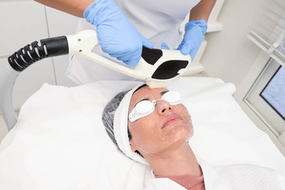 mira mesa ipl, san diego ipl treatment, local ipl treatment, ipl treatment near me