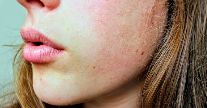 Why Your Skin Barrier Matters—And How to Fix It