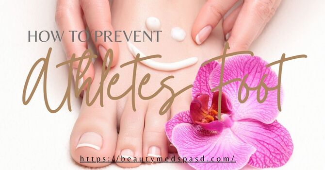 Athlete’s Foot: Symptoms & Solutions image